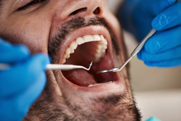 Best Broken or Cracked Tooth Emergency Dentist in Dallesport, WA